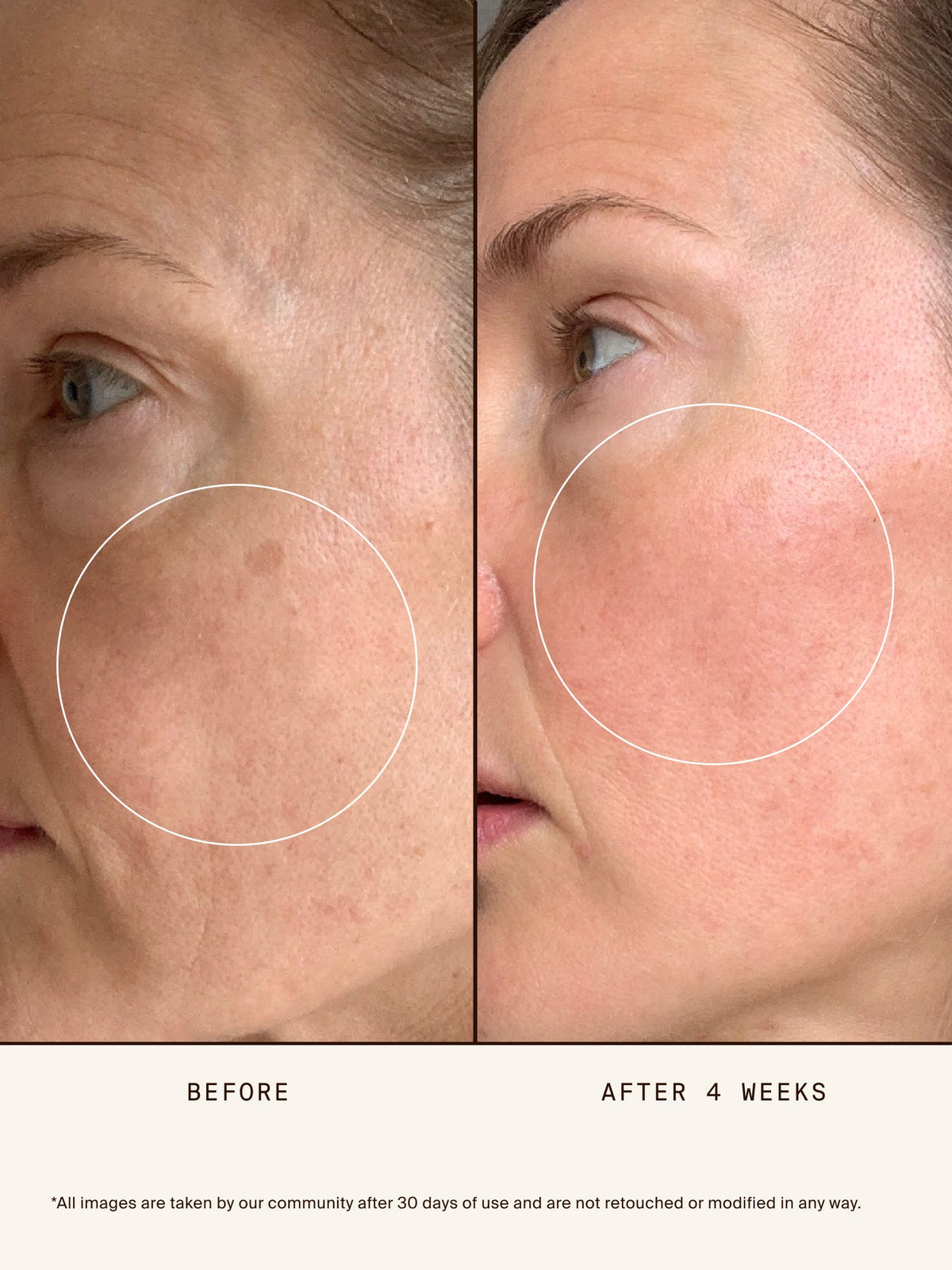 Chebula Active Serum benefits.