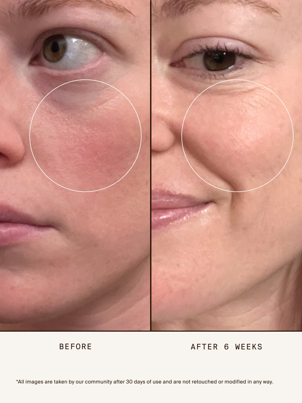 Woman applying Chebula Extreme Cream.