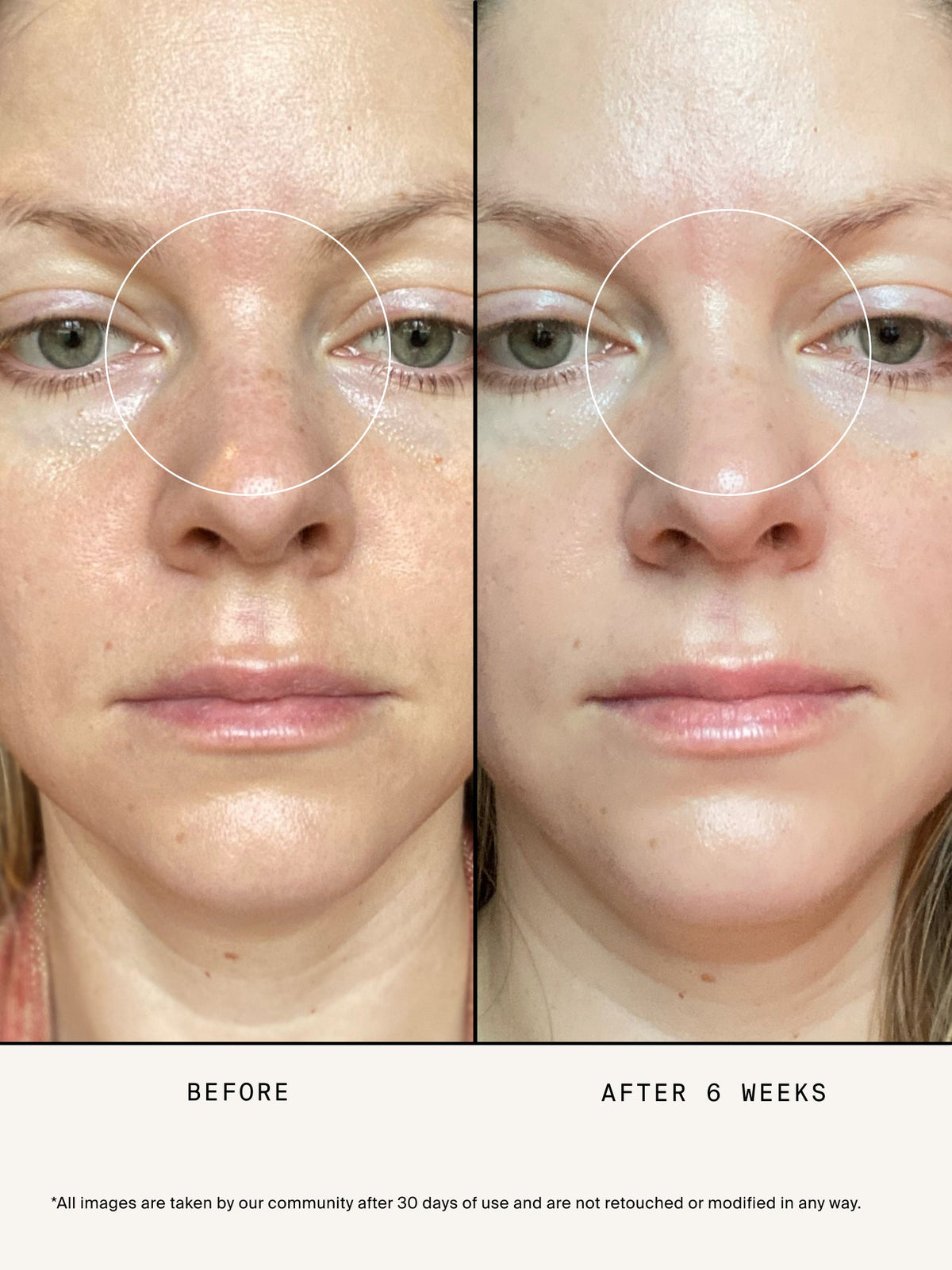 Vitamin C Serum Booster dermatologist recommended.